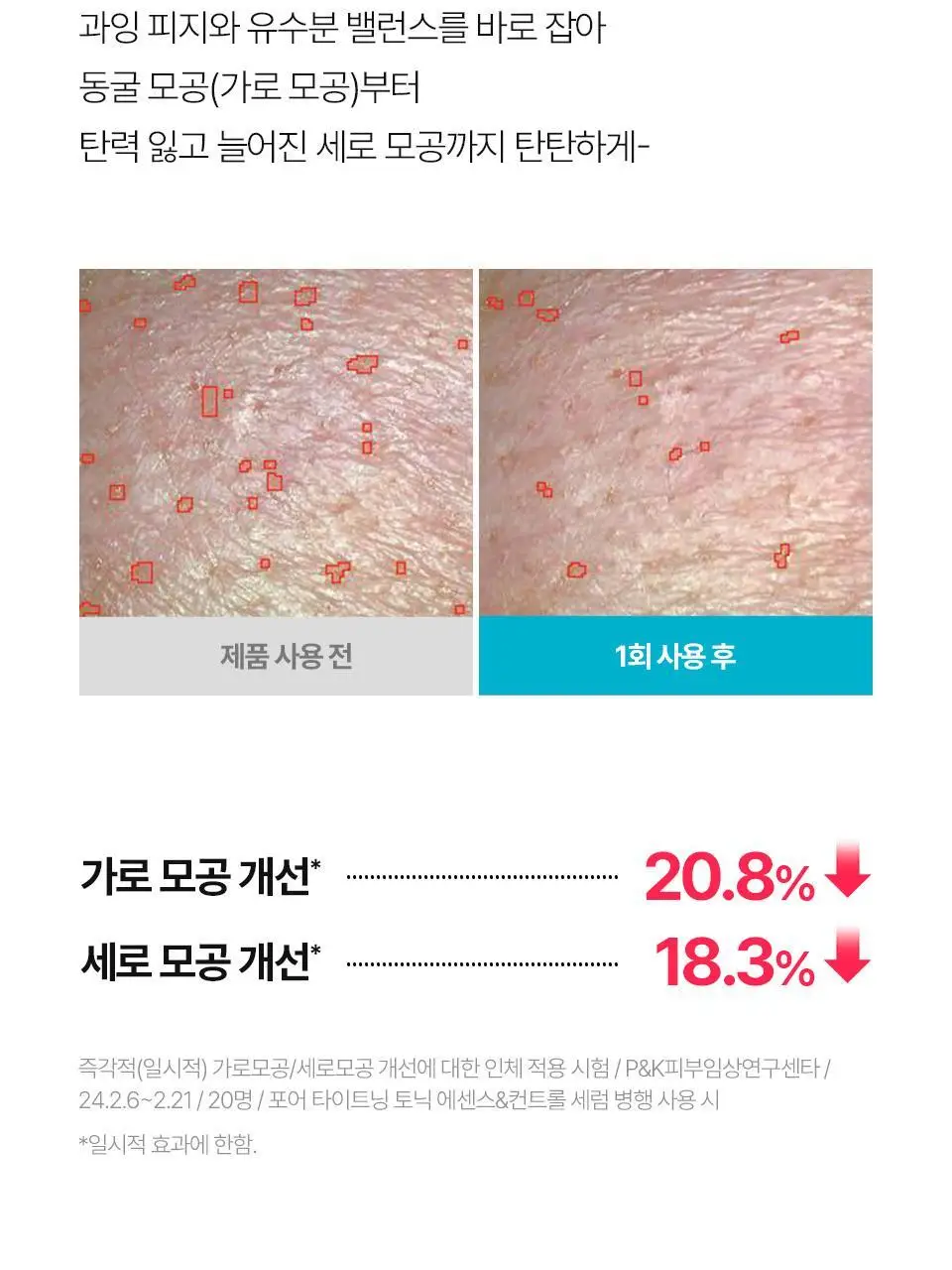 [모공탄력] 아이소이 포어 타이트닝 컨트롤 세럼 20ml 기획 (+3ml) 상세페이지 8